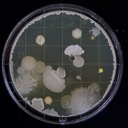 Bakterien und Keime Mülleimer mit Sensor